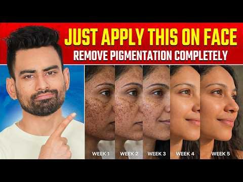 ⁣सिर्फ 7 दिन में कितनी भी पुरानी झाइयां, काले दाग धब्बे 100% जड़ से खत्म करें | Fit Tuber